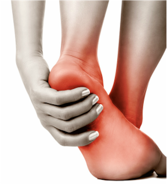 The runner's guide to plantar fasciitis